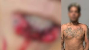 Homem é preso após atacar namorada e arrancar parte da
