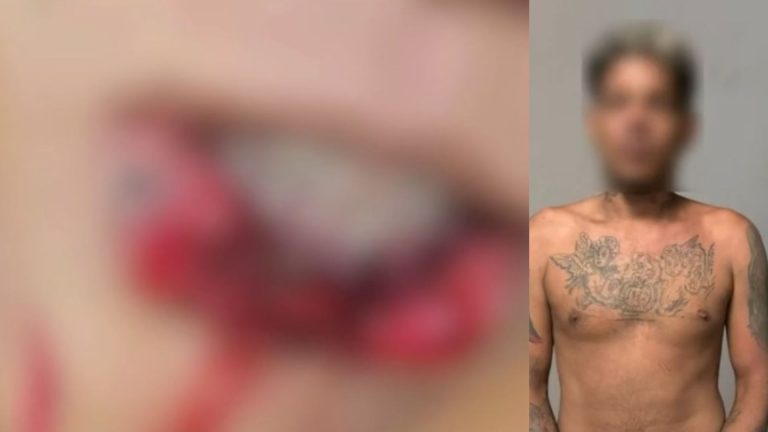 Homem é preso após atacar namorada e arrancar parte da