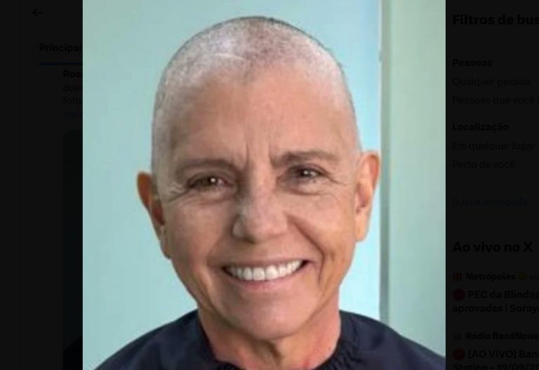 Roseana Sarney aparece de cabeça raspada em meio a tratamento