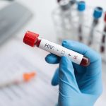 SUS pode oferecer terapia injetável contra o HIV