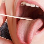 Como e por que a língua indica problemas de saúde?