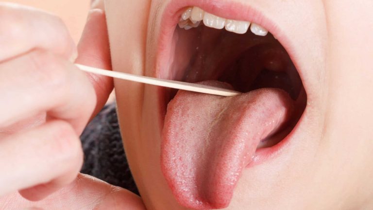 Como e por que a língua indica problemas de saúde?