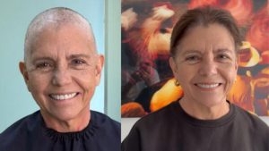 Estado de saúde de Roseana Sarney exige cuidados após sessões