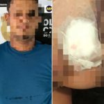 Homem é preso suspeito de atirar no rosto de ex-namorada