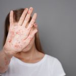 Saúde alerta para casos de sarampo e queda na vacinação