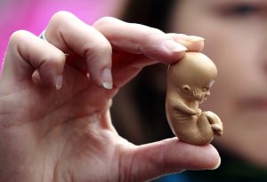 Senado aprova Projeto de Lei que restringe aborto legal após