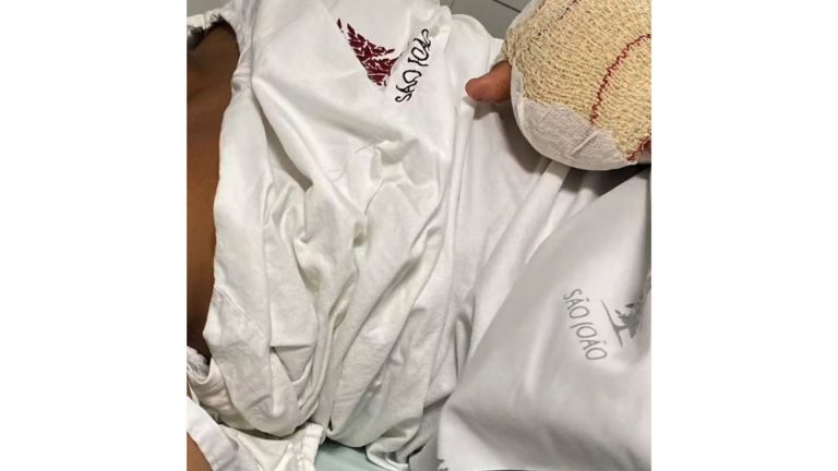 Aluno brasileiro tem dois dedos decepados em escola de Portugal