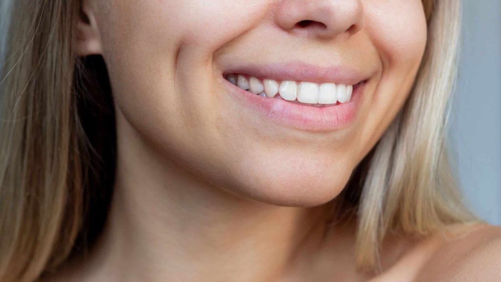 Gel revolucionário é capaz de reverter a erosão do esmalte