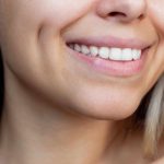 Gel revolucionário é capaz de reverter a erosão do esmalte