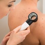 Robô inteligente atinge 94,5% de precisão em diagnóstico de melanoma