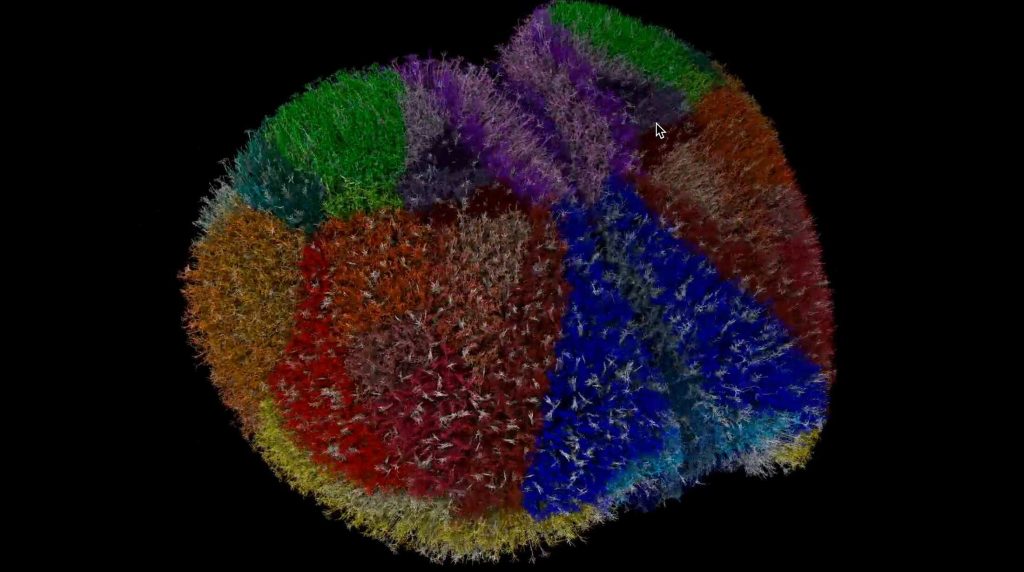 Simulação cerebral permite testar Alzheimer e epilepsia sem tecido real