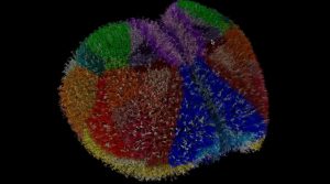 Simulação cerebral permite testar Alzheimer e epilepsia sem tecido real