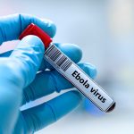 Ciência tenta quebrar a “capa de invisibilidade” do Ebola