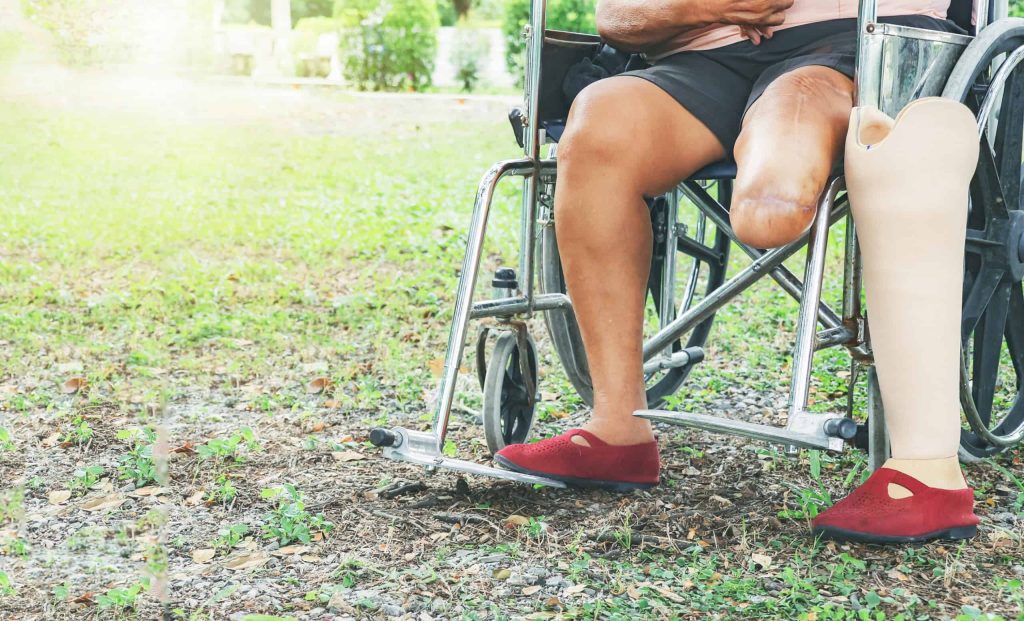 Diabetes: tecnologia brasileira pode cortar amputações pela metade