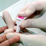 Mortes por aids caem 11% no Maranhão