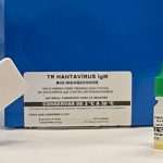Novo teste faz diagnóstico de hantavirose em 20 minutos