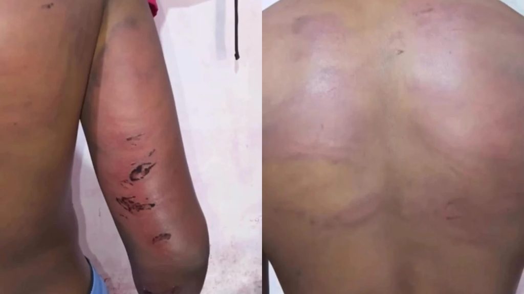 PM é afastado após denúncia de tortura contra adolescente em