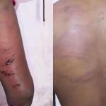 PM é afastado após denúncia de tortura contra adolescente em