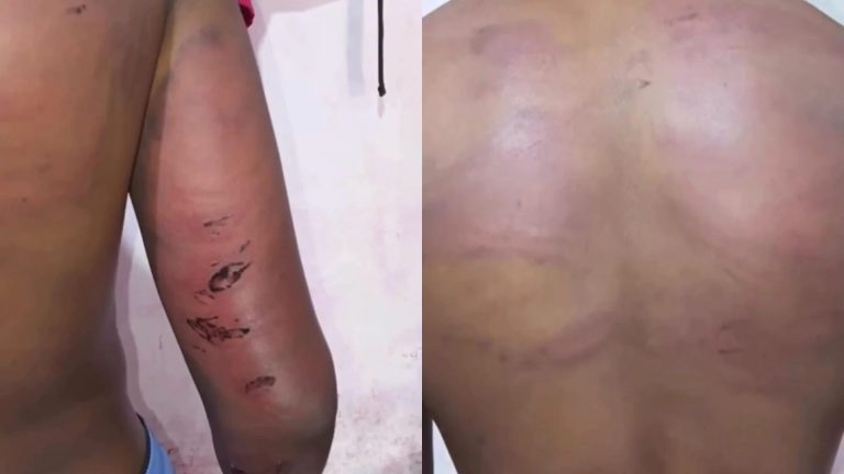 PM é afastado após denúncia de tortura contra adolescente em