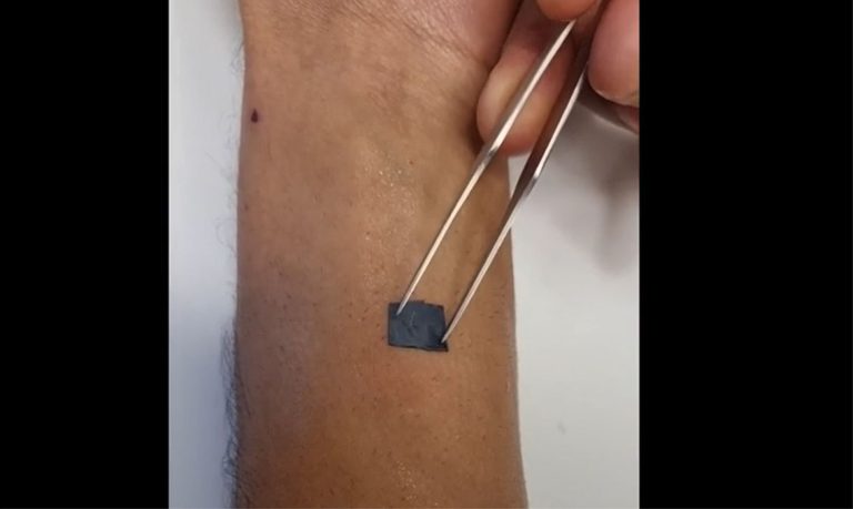 Tatuagem eletrônica monitora a saúde em tempo real