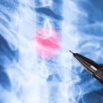 Anvisa libera estudo com substância que pode ajudar na recuperação