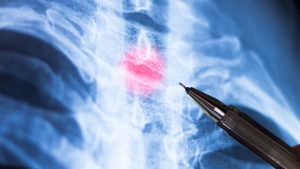 Anvisa libera estudo com substância que pode ajudar na recuperação