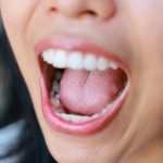 Como bactérias na boca podem indicar risco de obesidade