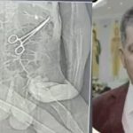 Homem morre após cirurgia e família diz que pinça foi