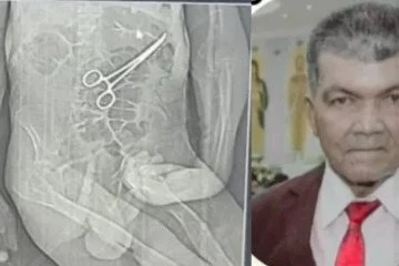 Homem morre após cirurgia e família diz que pinça foi