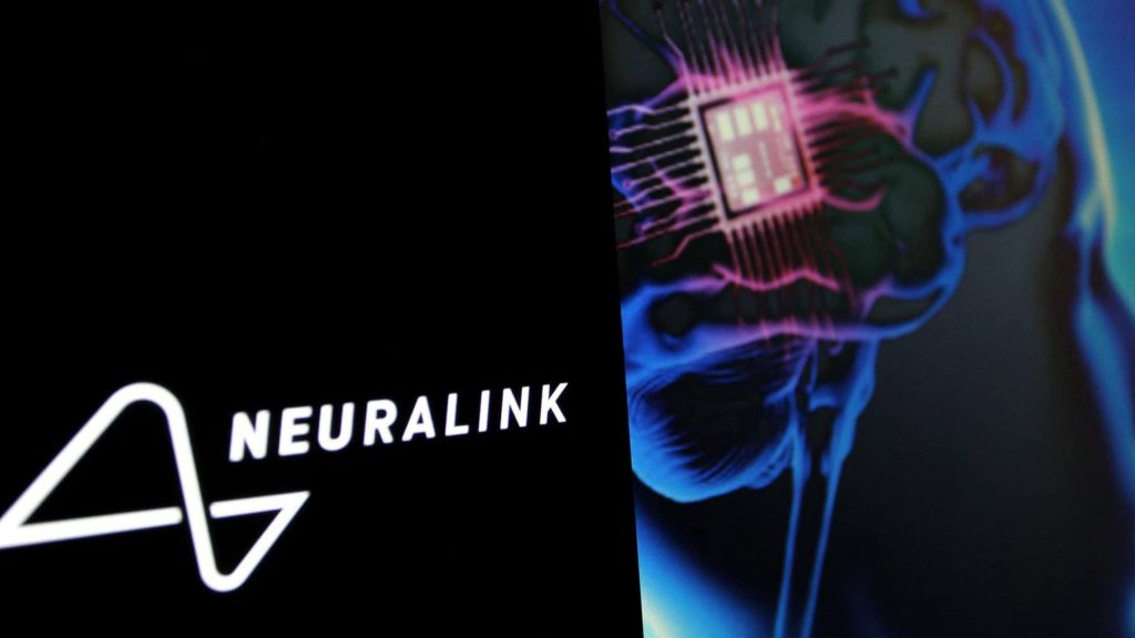 Neuralink mira produção em grande escala de implantes cerebrais
