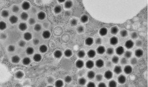 Vírus gigante recém-descoberto dá dicas sobre a origem da vida
